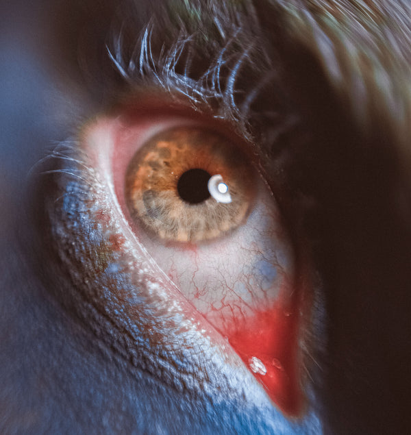 Red eye – what are the causes and how to treat it?