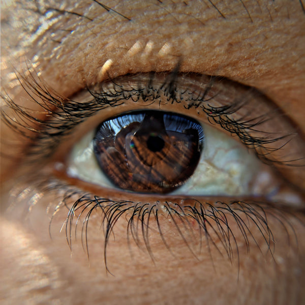 Corneal Abrasion – what are the causes and how to treat it?